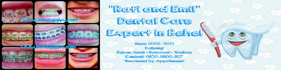 Behel Gigi Rafi Dental Care 0856-9866827
