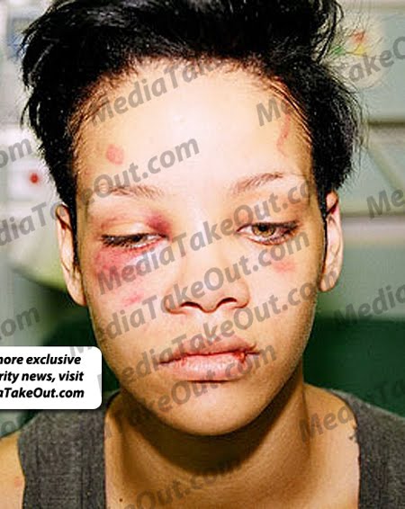 rihanna face beat up. Rihanna+eat+up+face+