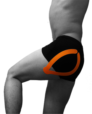 hip tape kinesio taping applications pain kinesiology step