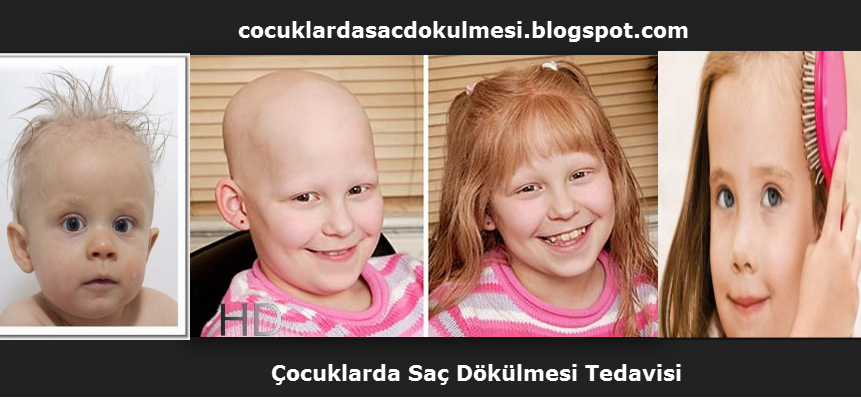 Cocuklarda Sac Dokulmesi
