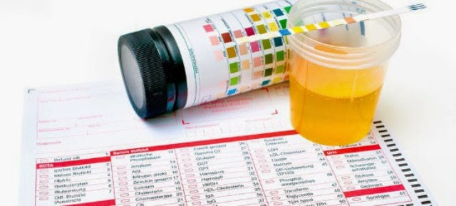 Reveal the Cost of Genital Herpes Test Cost