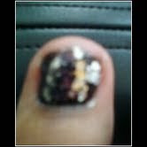 my toenail