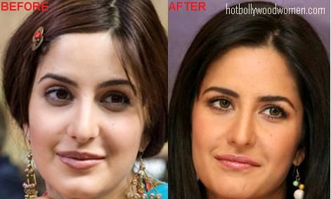 Hot Bollywood Celeb: Katrina Kaif Nose Plastic Surgery?