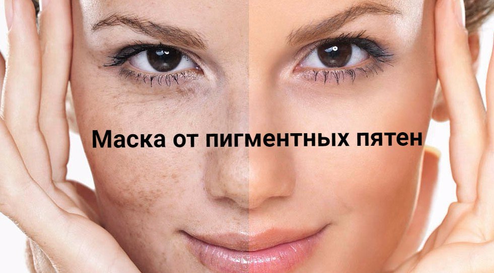 Маска от пигментных пятен на лице в домашних условиях отзывы Маска от пигментных пятен на лице в