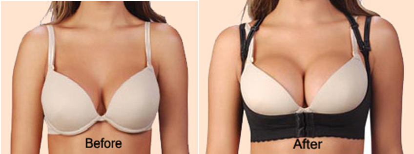 Bigger breasts before and after naturally