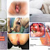 Mengobati Benjolan Wasir di Dekat Lubang Vagina thumbnail