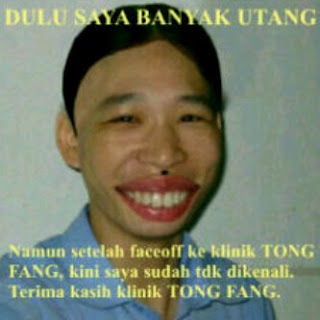 Saya Tuyul Pencuri Uang Warga Setelah Klinik Tongfeng Berhenti Saya Tuyul Pencuri Uang Warga Setelah Klinik Tongfeng Berhenti