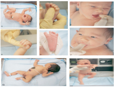 Aprende los reflejos del recién nacido de una manera fácil + VIDEO