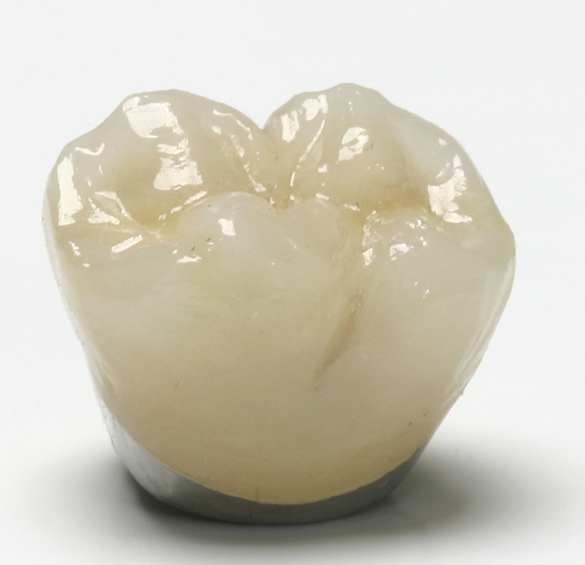 News Room ROE Dental Laboratory FixedFee Pricing on Crowns