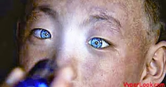 Chinese Boy with Ability to See in Pitch Black Stuns Medics