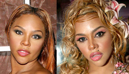   Plastic Surgery on Celebrity Lil Kim Plastic Surgery
