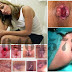 Memilih Obat Wasir: Ambeven, Faktu atau Ambeclear? thumbnail