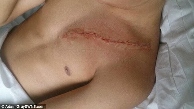 Teenager's chest sliced wide open leaving his heart almost exposed by knifeman who attacked twin brothers as they left a party