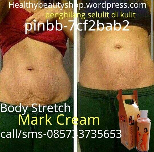 Body Stretch Mark Cream