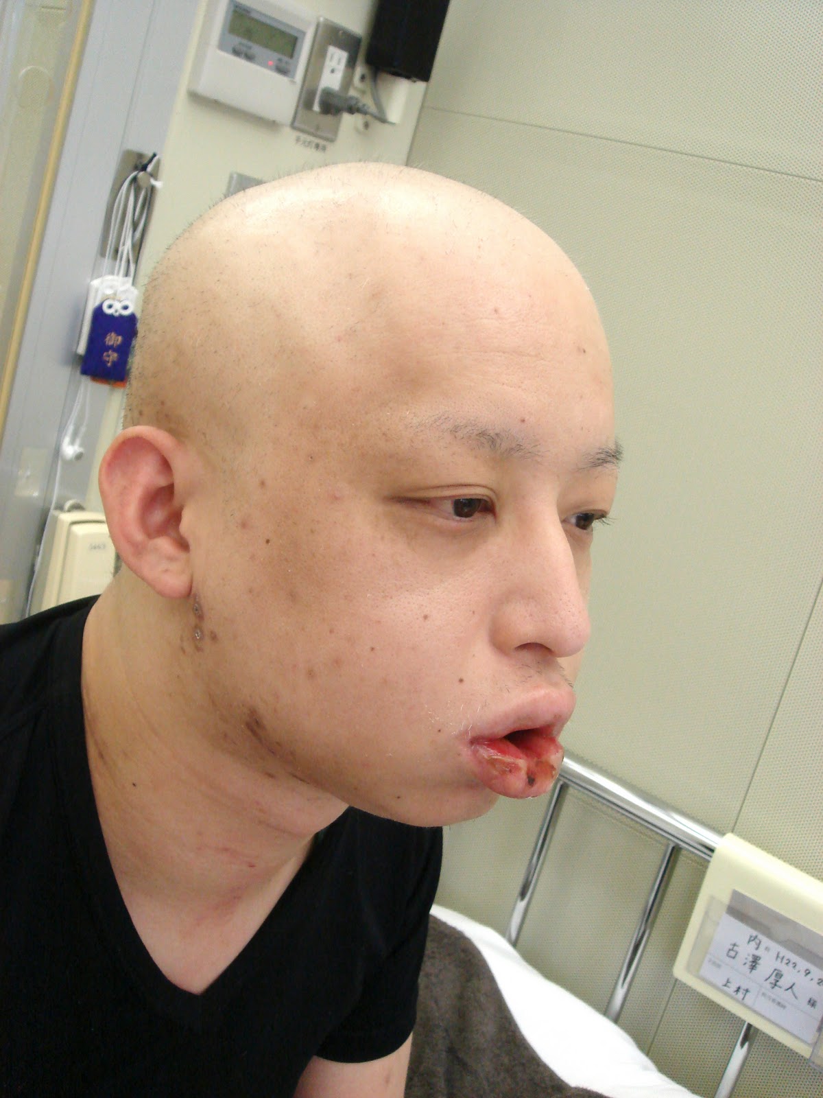 空白の三ヶ月…＜骨髄移植後〜無菌室脱出編＞ POSTA★Blog