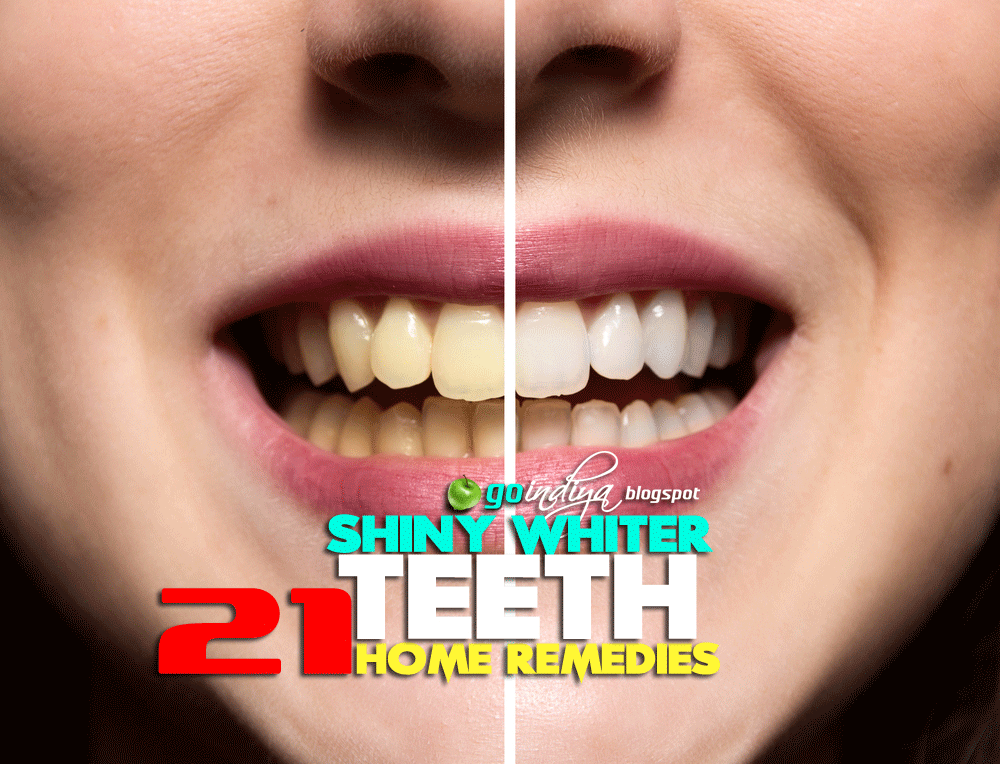 How to Whiten Extremely Yellow Teeth in 15 Days? 21 Teeth Whitening