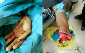 Ingat Pakis Ingat Monyet Tangan Putus Kerana Pulas Telinga Murid Atau Ada Cerita Lain