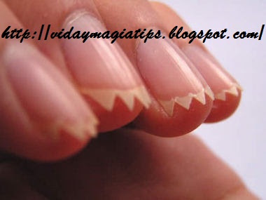 El hongo de las uñas en las manos el tratamiento los preparados las revocaciones de la foto