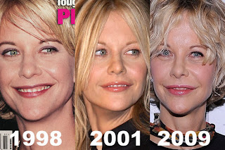 Jwoww    Plastic Surgery on Chatter Busy  Meg Ryan Plastic Surgery Before After