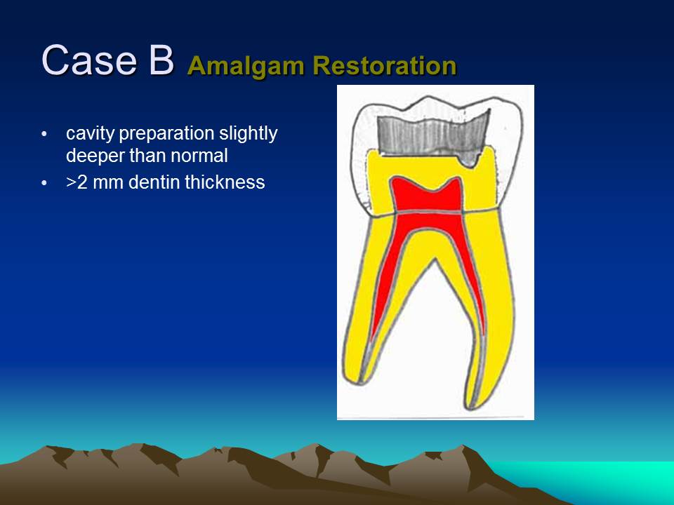 Dentistry Sealers, Liners and Bases