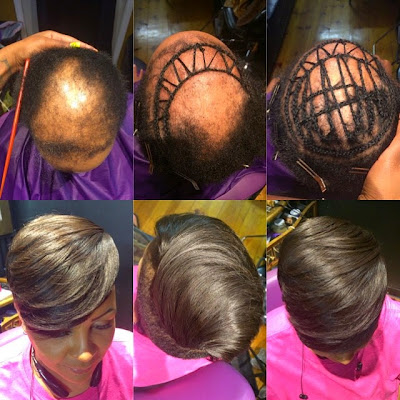 WOW! See How a Hairstylist Transformed an almost Bald Lady's Hair