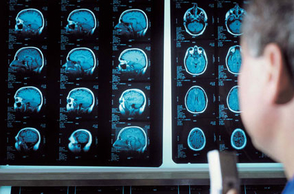 kanserle dans blogger