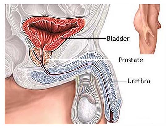 Bladder Cancer