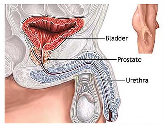 Is bloody urine a symptom of bladder cancer?