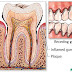 ¿Movilidad Dental? Periodontitis y Osteoporosis entre los culpables