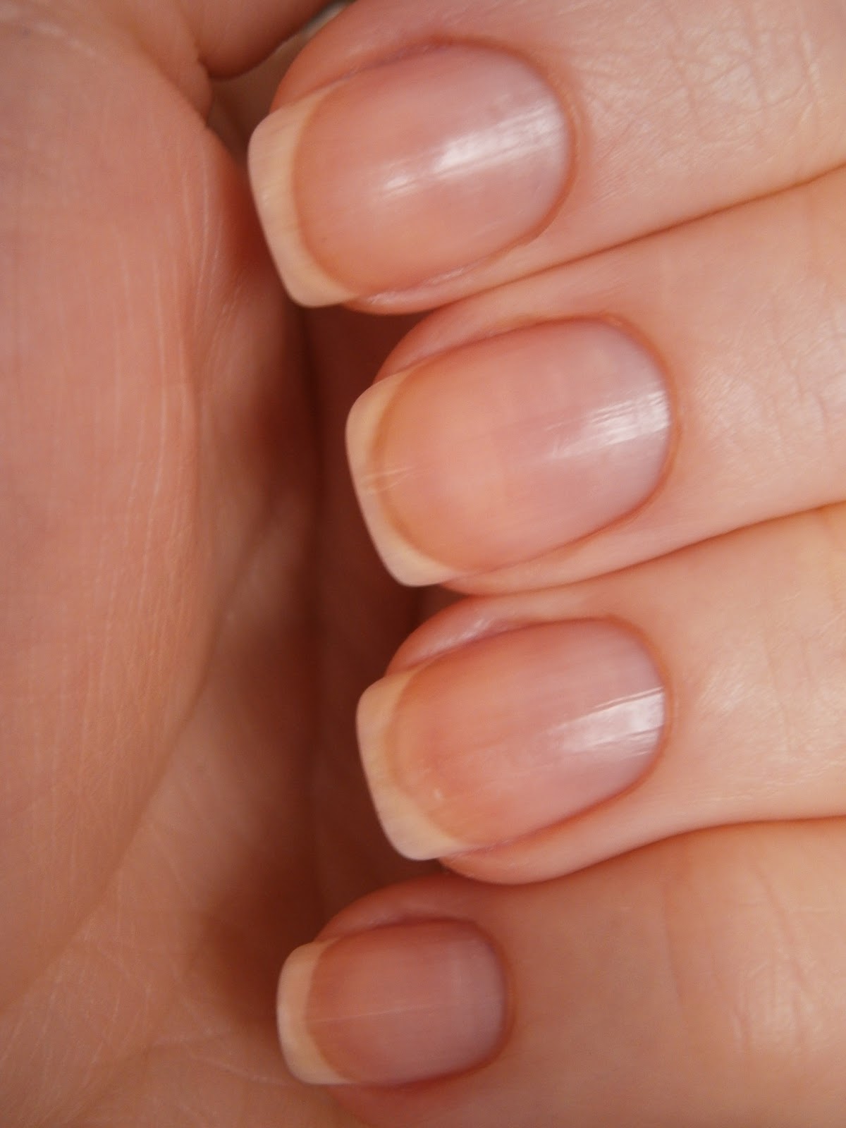 Почему ногти на руках становятся плоскими.