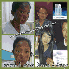 Skincerity | Nightly Breathable Masque | Masker Liquid Bernafas