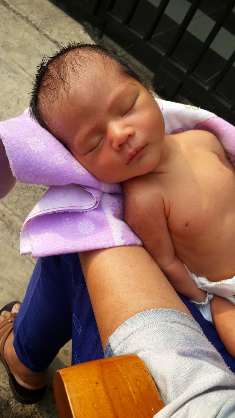 Fergie 1Mo