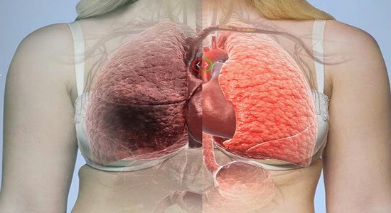 It’s Finally Discovered What Causes Lung Cancer! You Won’t Believe It When You Read What This Is About! It’s Finally Discovered What Causes Lung Cancer!
