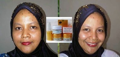 Bukti dan Testimoni Cream Walet Gold dan Serum Gold Bukti dan Testimoni Cream Walet Gold dan Serum Gold