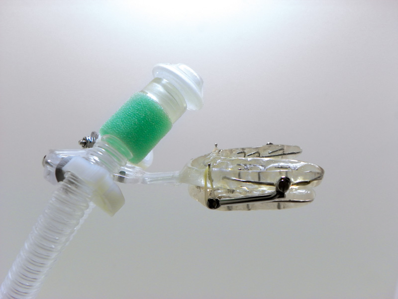 CPAP + Oral Appliance (AllInOne) Device for OSA