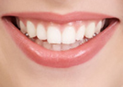 Healthy+gums+and+teeth