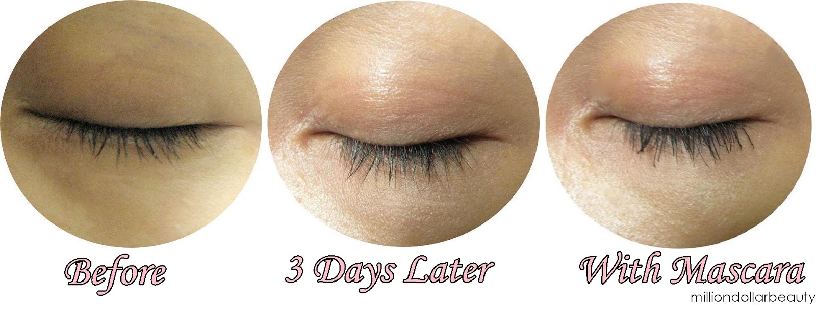 How I Lost All My Eyelash and How I Grow Them Back L'Oreal Renewal