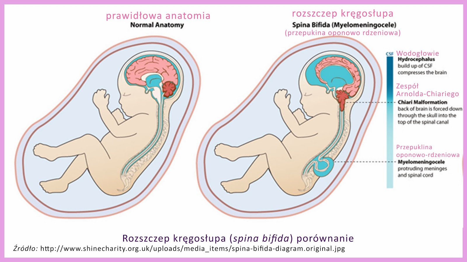 Usmiech Paulinki Nasza Historia