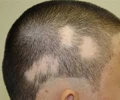 sackirancozum blogspot com