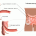 Intussusception def., causes, diagnosis, pathology, types, treatment Intussusception def., causes, diagnosis, pathology, types, treatment