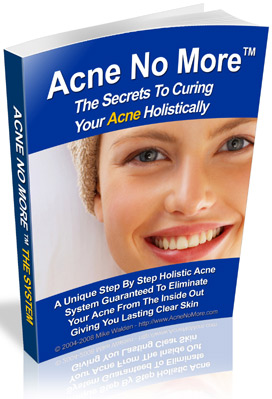 Acne No More Free Download