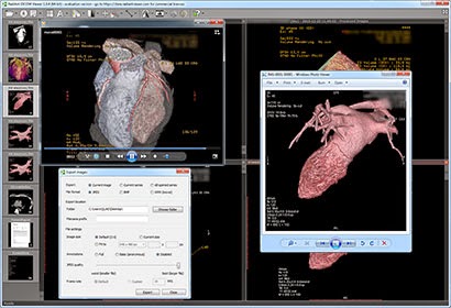 RadiAnt DICOM Viewer 5.0.0 Crack Free Licence Key