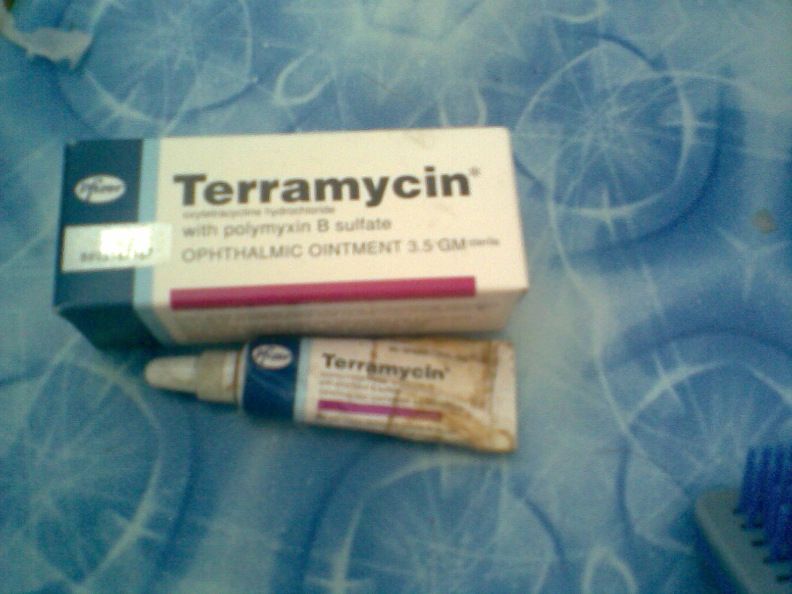 Sakit Mata  My CoRneR