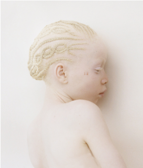 Wow honey photo albinos pussy really masterpiece