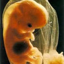 Imagenes-De-Bebes-Abortados Imagenes Bebes Abortados | Video di Porno Gratis: Film Sesso XXX, Foto ...