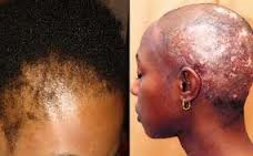 Kinksandcurls The Efficacy Of How Creams Aka Relaxers Mess With