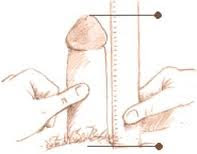 ANTERIOR AND POSTERIOR ANAL SPHINCTER REPAIR Chicks With Scars