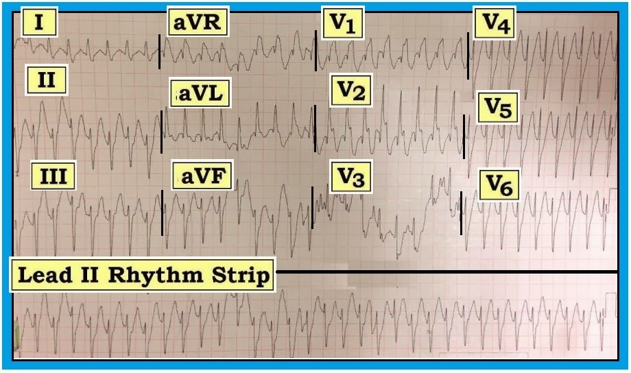 evaluation form for shoulder