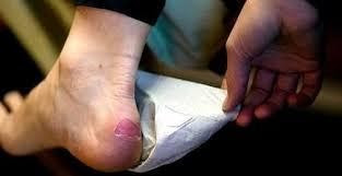 Pengertian Cedera Olahraga Definisi Macam Pecegahan dan Perawatan