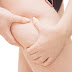 How To Get Rid Of Cellulite Naturally / Getting Rid of Cellulite Naturally